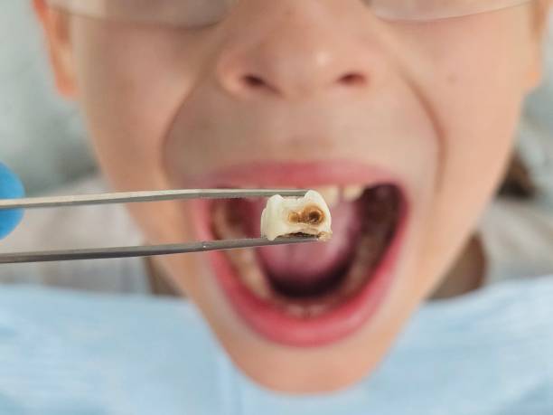 Best Emergency Dental Services for Seniors in Hackettstown, NJ